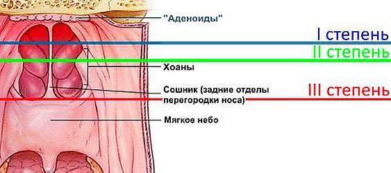 %D1%81%D0%B8%D0%BC%D0%BF%D1%82%D0%BE%D0%BC%D1%8B-%D0%B0%D0%B4%D0%B5%D0%BD%D0%BE%D0%B8%D0%B4%D0%BE%D0%B2.jpg