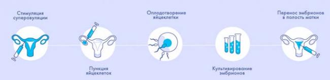 процедура ЭКО