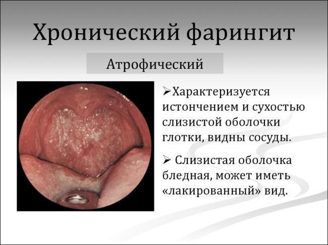 slide-8.jpg