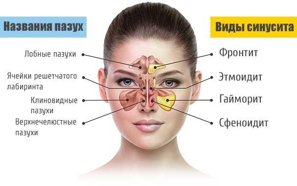 oslozhneniya-nasmorka.jpg