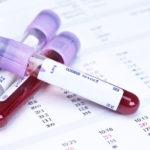Uroven-sahara-v-norme-i-pri-diabete-150x150.jpg