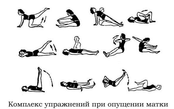упражнения Кегеля при опущении матки