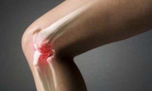 boli-pri-artroze-300x180.jpg