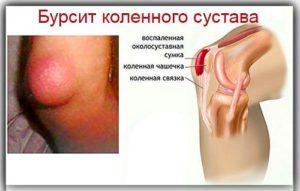 940e276bdc98f02c0303fd559c347e0b-300x191.jpg