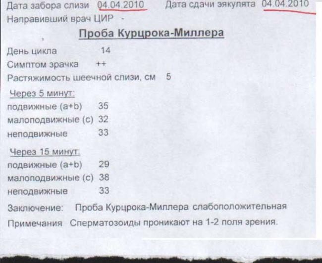 проба курцрока миллера положительная