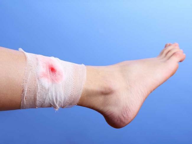 advanced-wound-healing.jpg