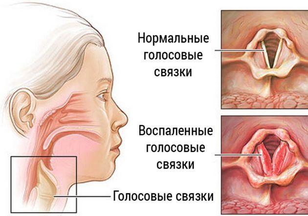 dvm0ng3l.jpg