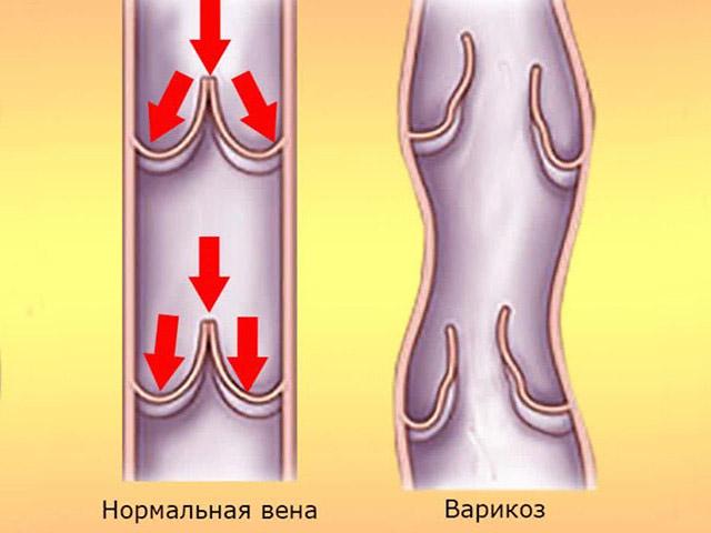 veni-na-chlene-5.jpg