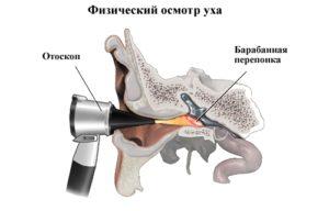 perforacyia_barabannoy_pereponky1-300x192.jpg