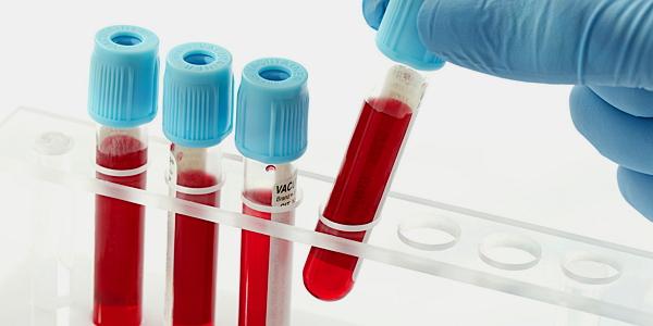 laboratornyi-analiz-krovi.jpg