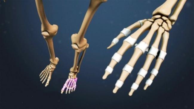 metatarsophalangeal-joints-ra-compressor.jpeg