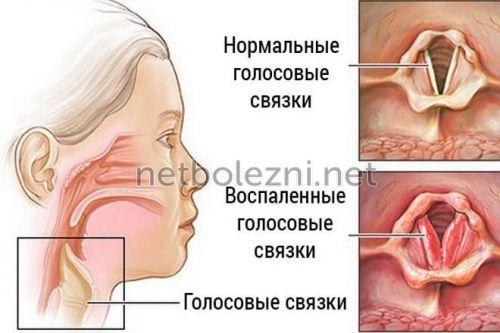 1499697831_golosovye-svyazki.jpg