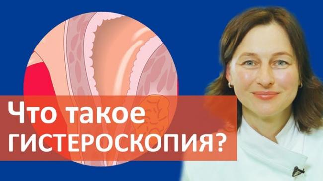 как делают гистероскопию матки