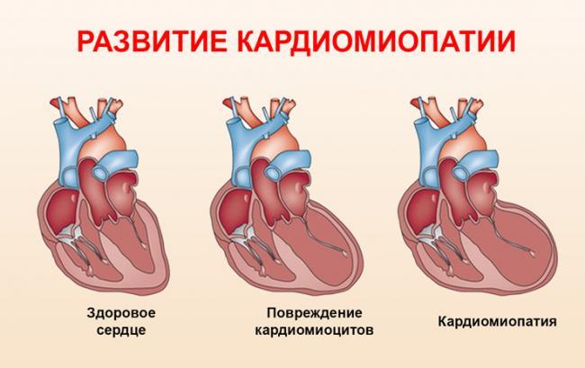odyshka-i-serdcebienie-prichiny_22.jpg