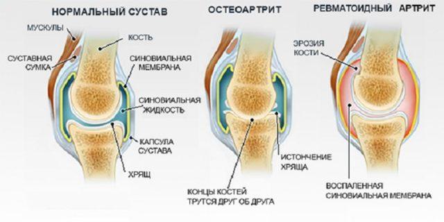 massazh-pri-zabolevanijah-sustavov-640x320.jpg