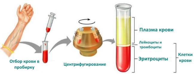 Gematokrit-ponizhen-chto-eto-znachit.png