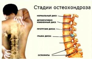 osteo2-300x195.jpg