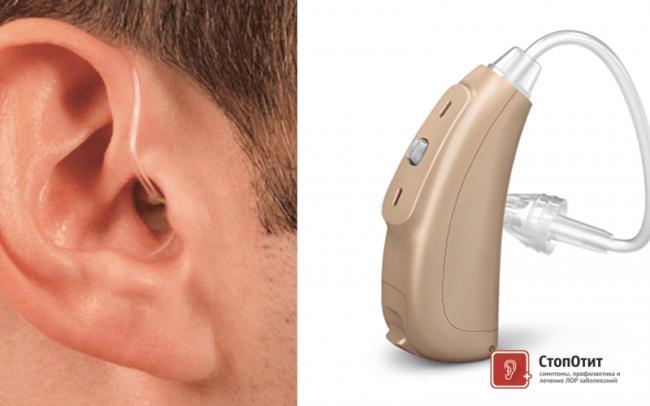 59f0c9648e70b_blog-hearing-technology.png