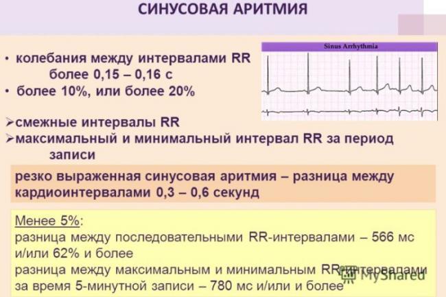 Sinusovaya-aritmiya-na-rezultate-analiza.jpg