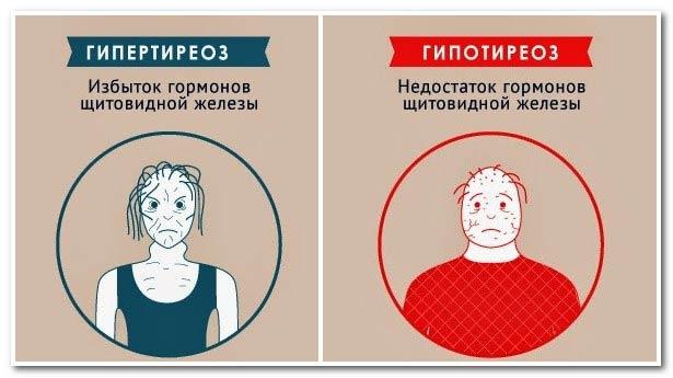 гормон щитовидной железы ттг