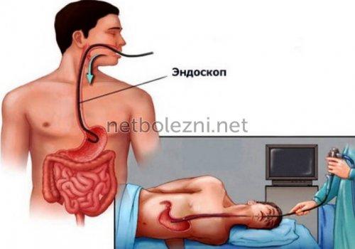 1558837591_endoskopiya-organov-zhkt.jpg