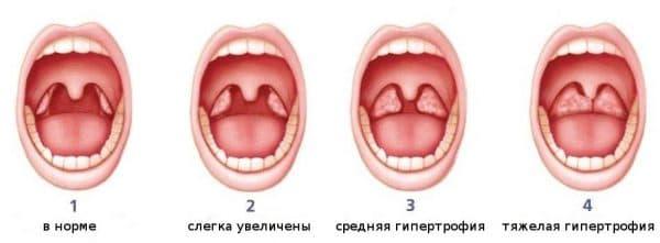%D1%81%D1%82%D0%B5%D0%BF%D0%B5%D0%BD%D0%B8-%D0%B0%D0%B4%D0%B5%D0%BD%D0%BE%D0%B8%D0%B4%D0%BE%D0%B2-600x221.jpg