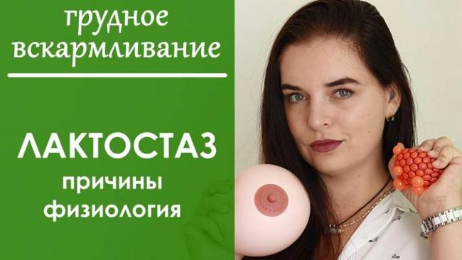 лактостаз у кормящей матери
