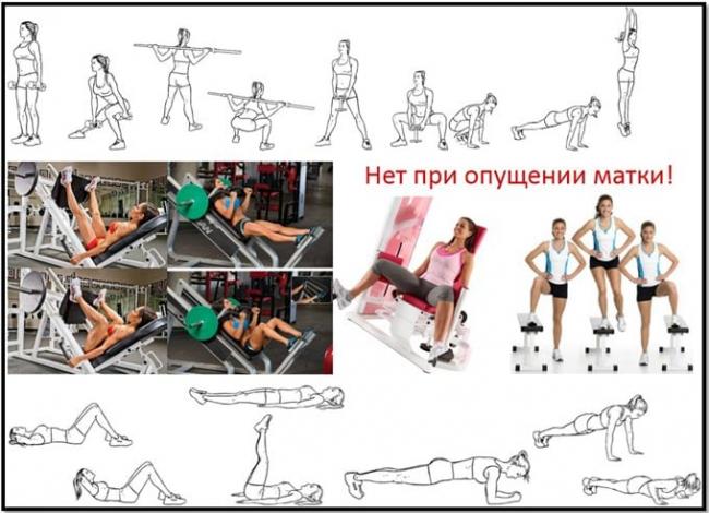 что нельзя делать при опущении матки