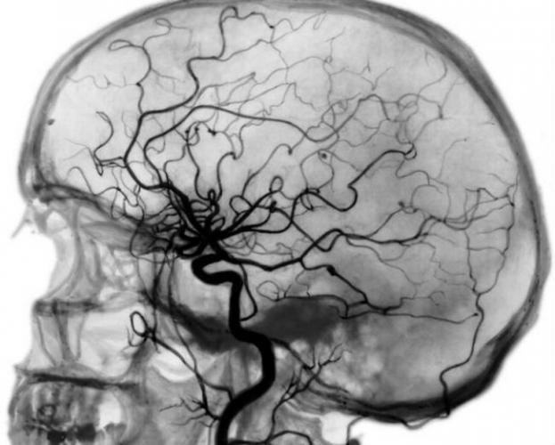 angiografiya1.jpg