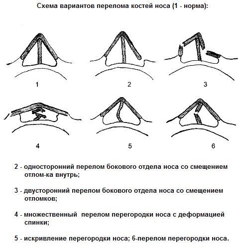 884648648.png