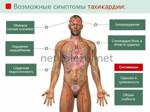 1497619818_simptomy-problem-s-serdcebieniem.jpg
