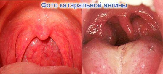 kataralnaya-foto.jpg