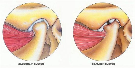 vosp-cheljustnogo-2-550x281.jpg