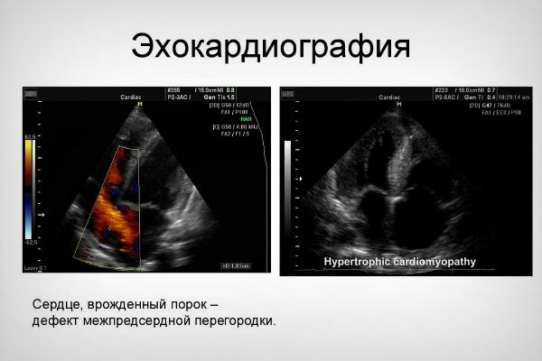 vrozhdennyj_48kb.jpg
