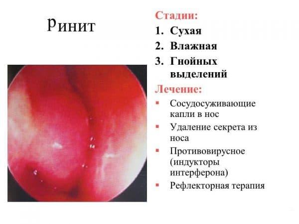 slide_19-600x450.jpg