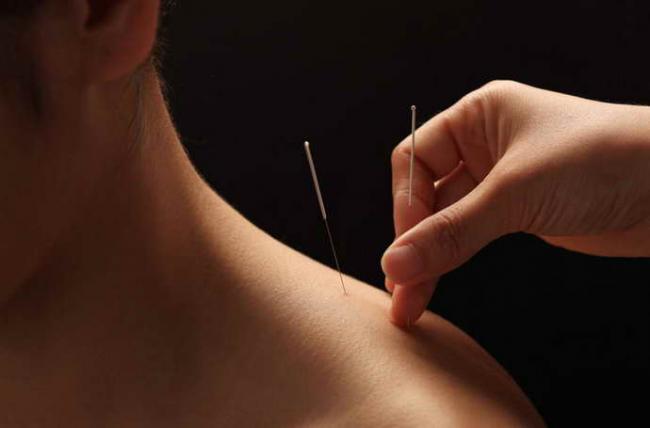 zashhemlenie-nerva-v-plechevom-sustave-simptomy-i-lechenie-4.jpg