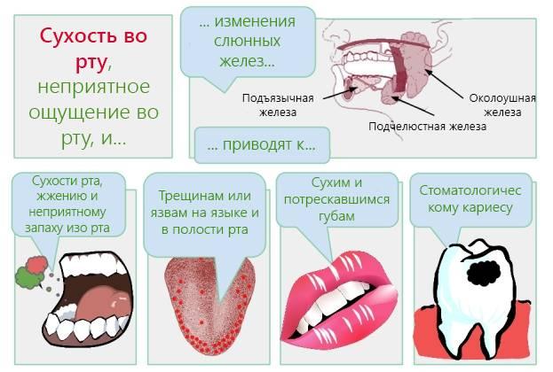 Simptomy-kserostomii.png