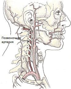 sindrom-vertebralnoj-arterii.jpg
