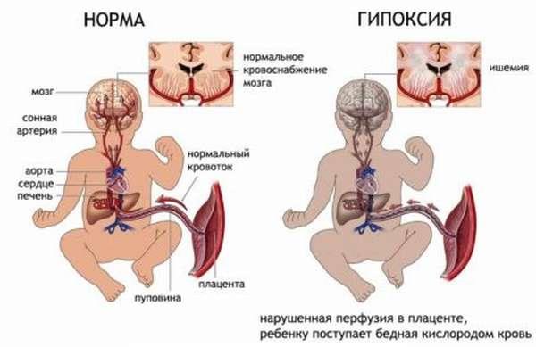 Повышение гематокрита у ребенка: причины и способы устранения проблемы