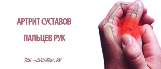 artrit-sustavov-paltsev-ruk-640x274.jpg