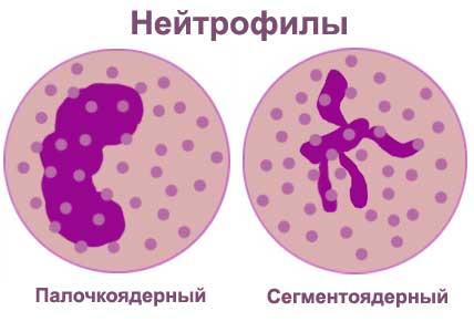 vidi-neytrofilov(2).jpg