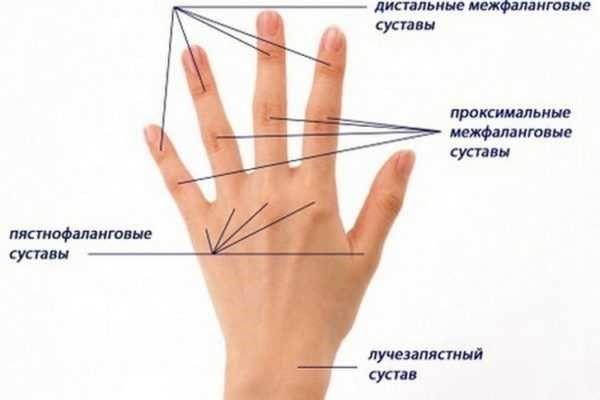 osteoartroz-kstrklc-2-600x400.jpg