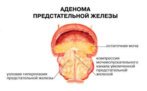 psa_dgpzh-480x299.jpg