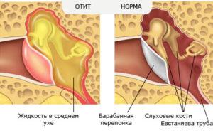f064a9d303d6a4c00544982bb5e550cf-300x187.jpg