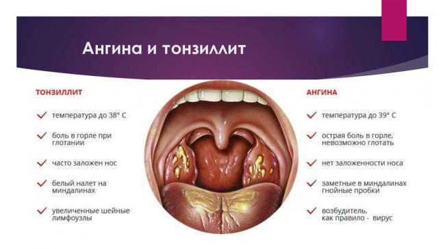 Angina-1024x574.jpg