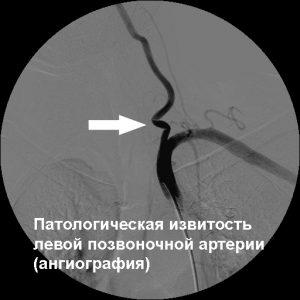 sonart1-300x300.jpg