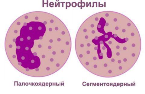 neitropeniya_u_vzroslyh_vidy-480x312.jpg