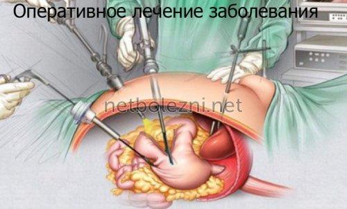 1558837829_operativnoe-lechenie-zabolevaniya.jpg