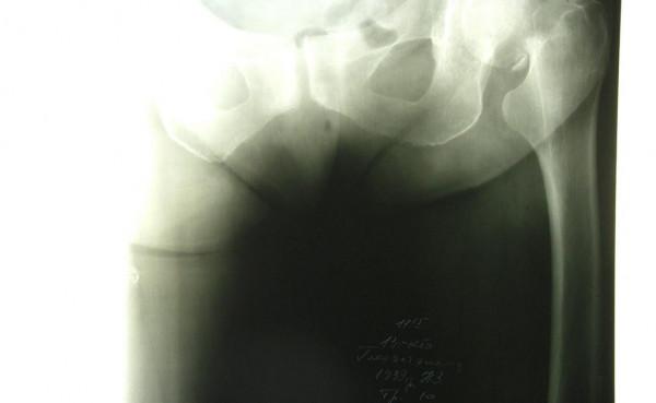 rentgen_taza_2_0.jpg
