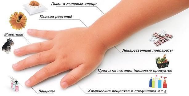 allergicheskij-laringit-2.jpg